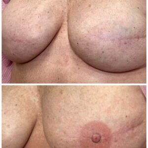 3d areola 19