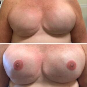 3d areola 5copy