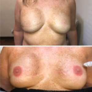 3d areola 6copy