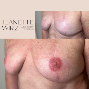 3D areola results (October) (1)