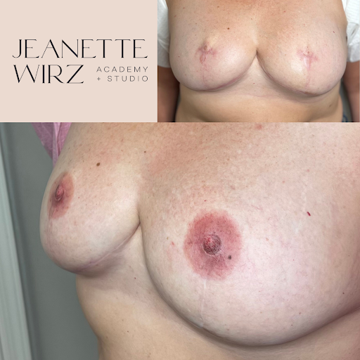 3D areola 1 copy